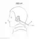 Fig. 23 - Headset