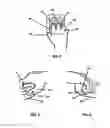 Fig. 04 - TWO FINGER OR THREE FINGER PET BRUSH
