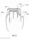 Fig. 11 - TWO FINGER OR THREE FINGER PET BRUSH