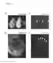 Fig. 14 - METHOD FOR PRODUCING CHIMERIC ANIMAL