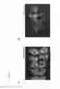 Fig. 15 - METHOD FOR PRODUCING CHIMERIC ANIMAL