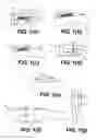 Fig. 02 - Fishing lure having an inertially-activated pivotable hook system