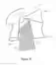 Fig. 10 - INSECT CONTROL DEVICE