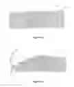 Fig. 11 - INSECT CONTROL DEVICE
