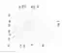 Fig. 04 - Illuminated garment system and method of using the same
