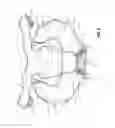 Fig. 06 - PERSONAL PROTECTION DEVICE