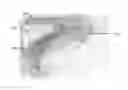 Fig. 01 - Face shield for reducing facial injuries