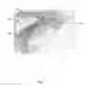 Fig. 04 - Face shield for reducing facial injuries