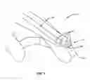 Fig. 04 - Hands-free suctioning device