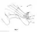 Fig. 05 - Hands-free suctioning device
