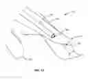 Fig. 11 - Hands-free suctioning device