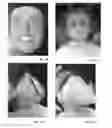 Fig. 09 - MASK FOR A DOLL