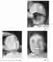 Fig. 11 - MASK FOR A DOLL