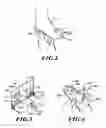Fig. 03 - Methods and apparatuses for making custom orthotics, insoles and other footwear inserts