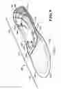 Fig. 07 - Methods and apparatuses for making custom orthotics, insoles and other footwear inserts