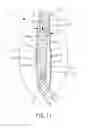 Fig. 12 - Oral care implement