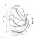 Fig. 11 - EGG POACHING DEVICE