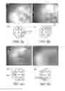 Fig. 04 - Imaging a patient's interior