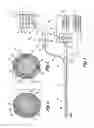 Fig. 02 - Fiber optic imaging catheter
