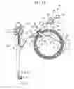 Fig. 14 - Packaging material for endoscopic treatment system and endoscope system