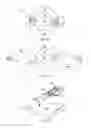 Fig. 02 - Rotation of outrigger during medical procedure