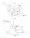 Fig. 04 - Rotation of outrigger during medical procedure