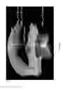 Fig. 26 - Method and system for eye measurements and cataract surgery planning using vector function derived from prior surgeries