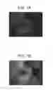 Fig. 08 - Scanning laser ophthalmoscope