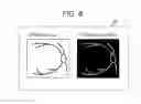 Fig. 09 - Scanning laser ophthalmoscope