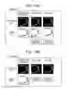 Fig. 11 - Scanning laser ophthalmoscope