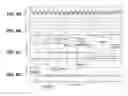 Fig. 07 - Systems and methods to determine HR, RR, and classify cardiac rhythms based on atrial IEGM and atrial pressure signals