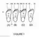 Fig. 02 - FOOT MORPHOMETRIC MEASURING DEVICE