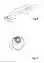 Fig. 03 - Device For Measuring The Diameter Of An Aortic Valve
