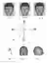 Fig. 02 - Method for the automated and assisted acquisition of anatomical surfaces