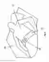 Fig. 04 - Method and device for sleep posture correction