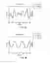 Fig. 04 - Methods and systems for rapid screening of mild traumatic brain injury