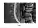 Fig. 03 - Measure of disc degeneration and pathology