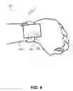 Fig. 05 - Neuropathic Assistive Device