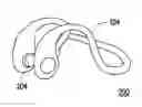 Fig. 01 - Exercise physiological sensing system, motion artifact suppression processing method and device