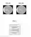 Fig. 03 - Medical image diagnosis apparatus and control method