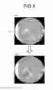 Fig. 07 - Medical image diagnosis apparatus and control method