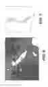 Fig. 06 - Method and system for image processing and patient-specific modeling of blood flow