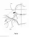 Fig. 06 - X-ray beam shaping