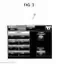 Fig. 04 - Medical system