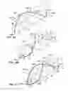 Fig. 05 - Endoluminal filter having enhanced echogenic properties