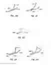 Fig. 16 - Endoluminal filter having enhanced echogenic properties