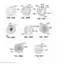Fig. 32 - Endoluminal filter having enhanced echogenic properties