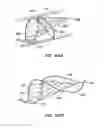 Fig. 34 - Endoluminal filter having enhanced echogenic properties