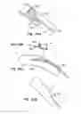 Fig. 43 - Endoluminal filter having enhanced echogenic properties