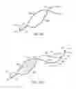 Fig. 59 - Endoluminal filter having enhanced echogenic properties